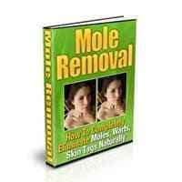Enlèvement des moles